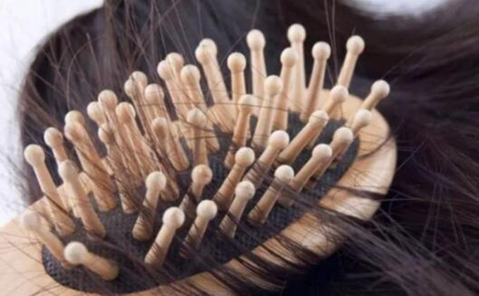 女生脱发怎么办脱发原因有哪些 治疗脱发还得对症下药