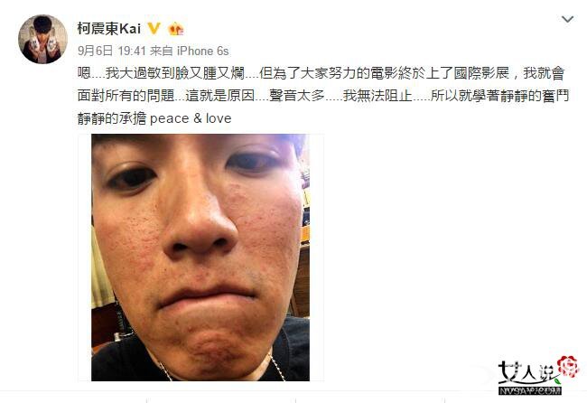 柯震东被封杀后现状 吸毒复出如今“颜值全无”