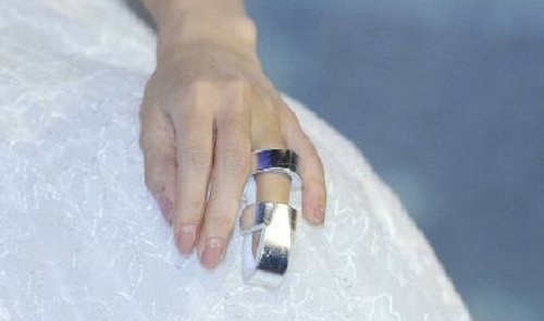 baby身穿白色连衣裙出席活动仙气十足 手戴固定钢板保护受伤手指